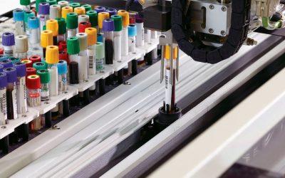 The 5 Benefits of Working with Automated Test Equipment Companies (revised Nov 2018)
